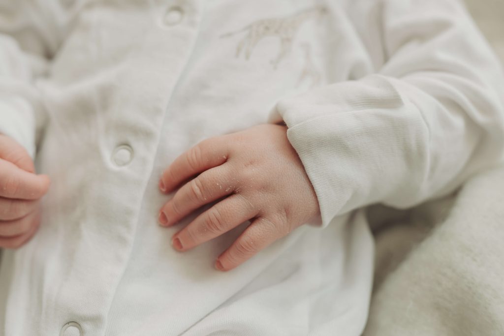 close up of flaky skin and hand