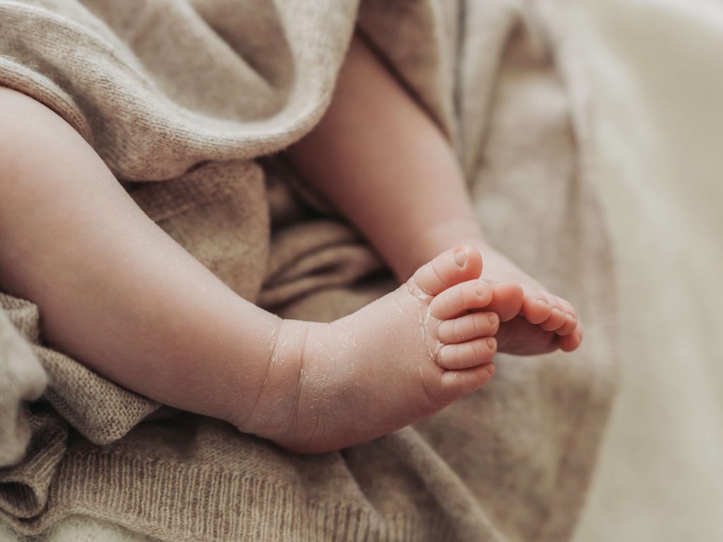 baby feet with flaky skin